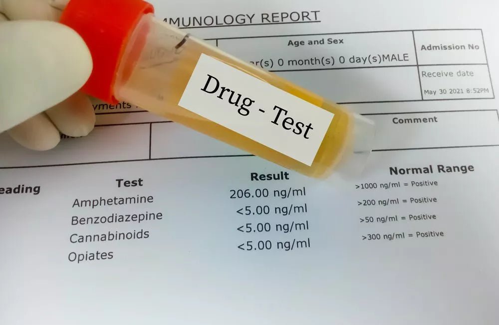 Delta-8 THC: Legality, Drug Tests, and Everything You Need to Know